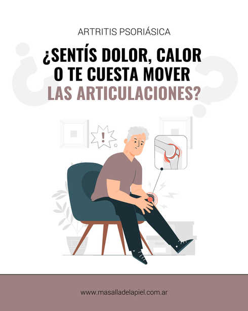 Imagen ilustrativa sobre map dolor articulaciones