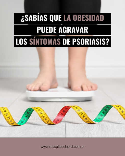 Imagen ilustrativa sobre map obesidad psoriasis