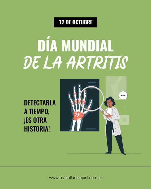 Imagen ilustrativa sobre map dia artritis