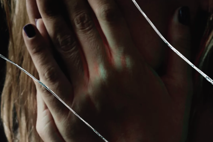 Psoriasis y Depresión