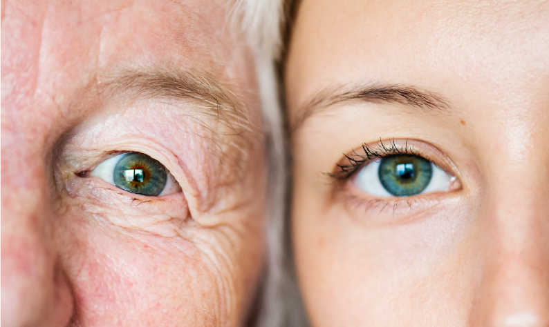 Imagen ilustrativa psoriasis hereditaria